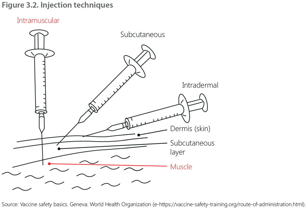 Figure 3.2. Injection techniques