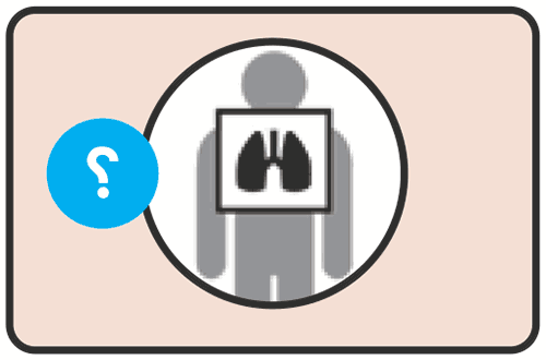 CXR screening