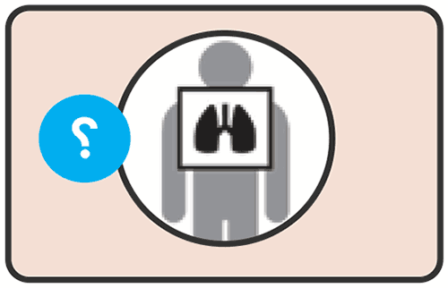 Chest X-ray