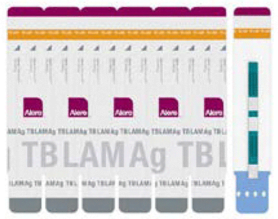  Urine LF-LAM assay