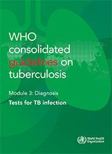 Module 3 - test tb infection